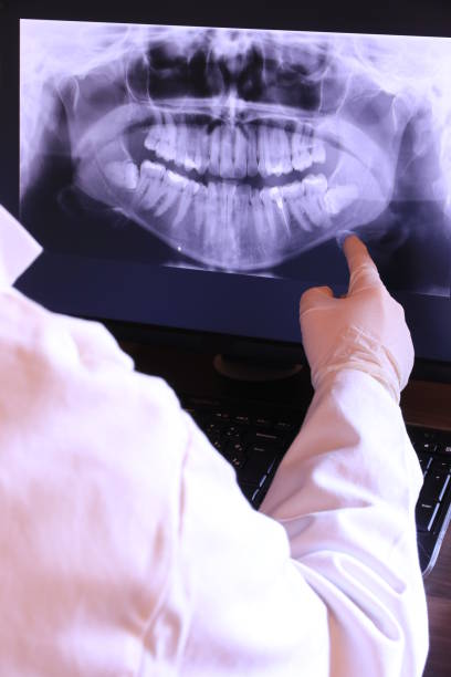 Best Emergency Treatment for Oral Infections in Middlefield, OH